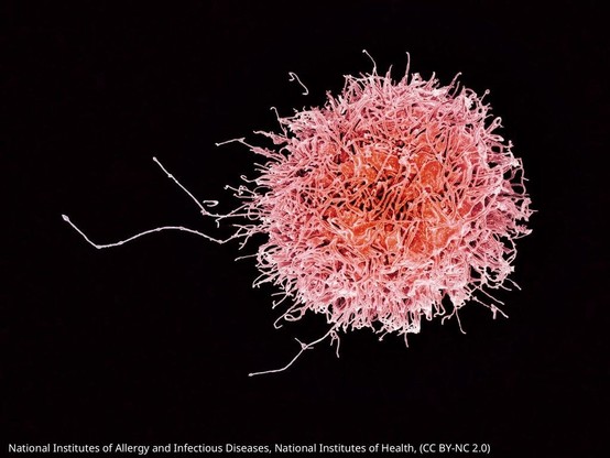 natural t killer cell in pink on a black background